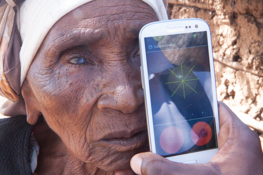 Woman being tested using cataract app on Samsung phone